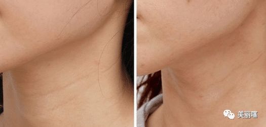 5款总被误认为是“地摊货”的宝贝，看到第1名，网友：不敢想象