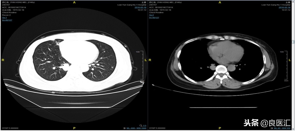 美图秀秀成功案例,美图秀秀实战案例