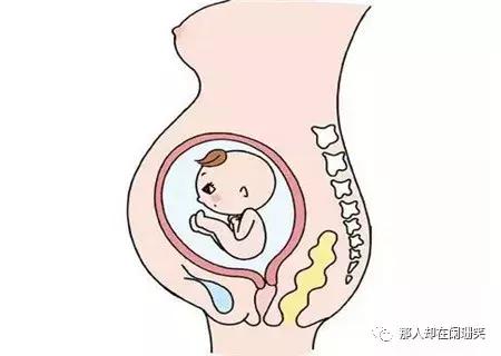 胎儿臀位最晚什么时候能转为头位,胎儿头位和横位有什么区别