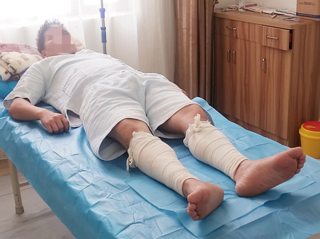 昆明三一一医院收费贵吗,昆明三一一医院康复医学