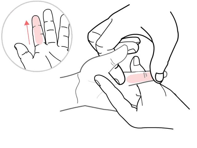 儿童有眼屎多且黄是怎么回事,小孩子突然眼屎多又黄粘稠怎么办