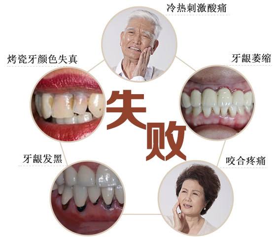 我的烤瓷牙掉了,烤瓷牙崩瓷了怎么办