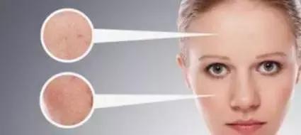 皮肤长斑有民间小方法祛斑吗,教你几招简单祛斑小方法