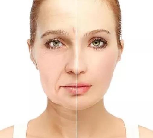 刘亦菲发腮什么意思,发腮的原因找到了