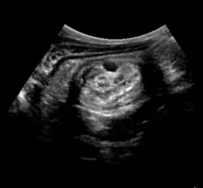 宠物细小病毒好了还吐是肠套叠,狗狗细小病毒不会流口水吧