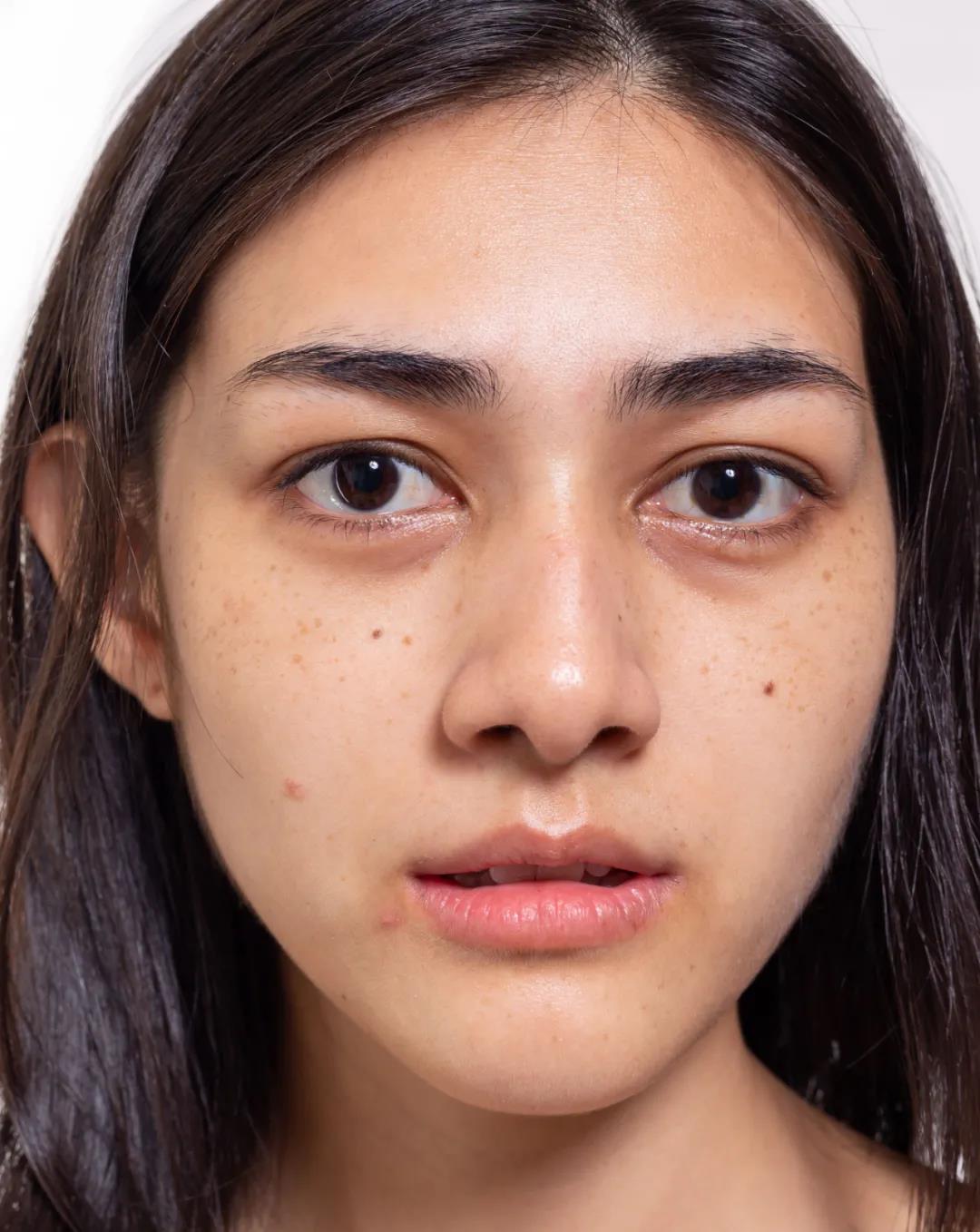 照片有黑眼圈怎么去除,照片怎么加黑眼圈