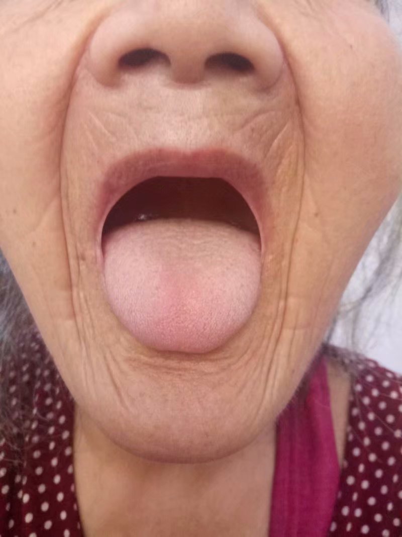 黄贵生老师讲胆经腿疼,黄贵生老师讲胆经