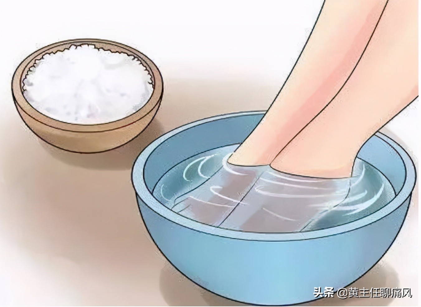 两种告别痛风的方法,这种方法治疗痛风效果好
