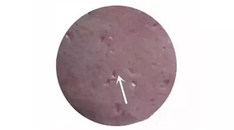 手把手教你正确挤痘不留坑,挤痘有个坑怎么补救