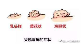 为什么说检测低危型HPV没有意义?低危型HPV阳性是否=尖锐湿疣?