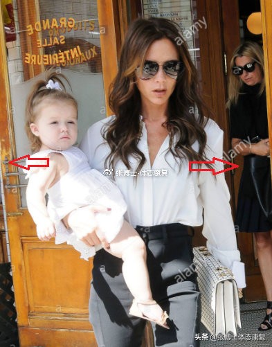 【案例分析】宝妈经常单手抱孩子腰痛怎么破,这篇文章会告诉你