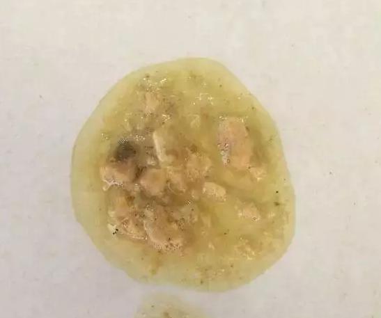 猫吐出的黄水里面有寄生虫,猫呕吐吐出虫子怎么办