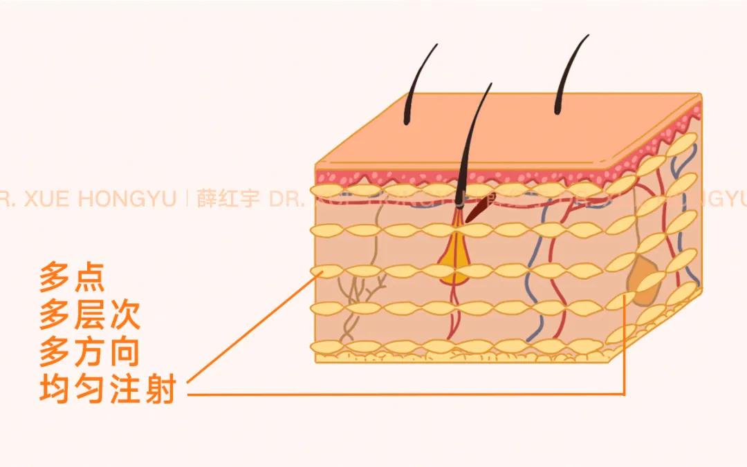 自体脂肪移植后的图片,自体脂肪移植丰胸丰臀