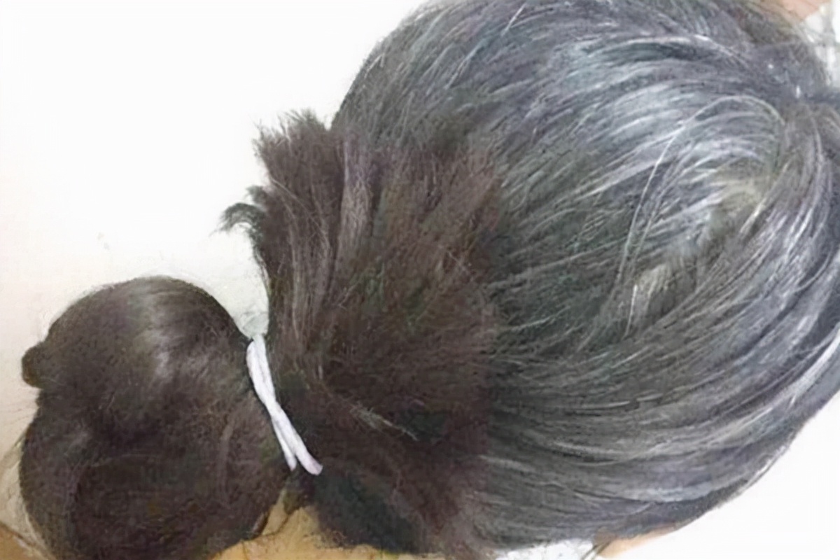 女性突然长出白发，是变老了吗？不一定，也可能是身体缺4种营养