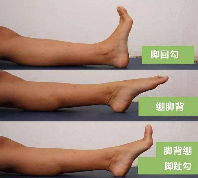 跳绳后膝盖后面的一整根筋疼,跳绳膝盖疼痛吃什么药