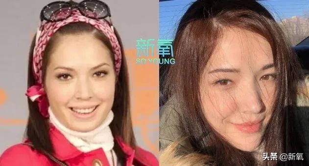 盘点整容后不敢认的女星颜值巅峰,知名女网红被扒整容