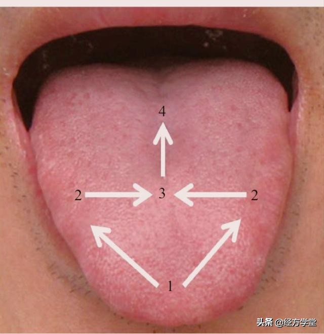 观舌养生舌诊入门一学就会,舌诊图片与经方治疗