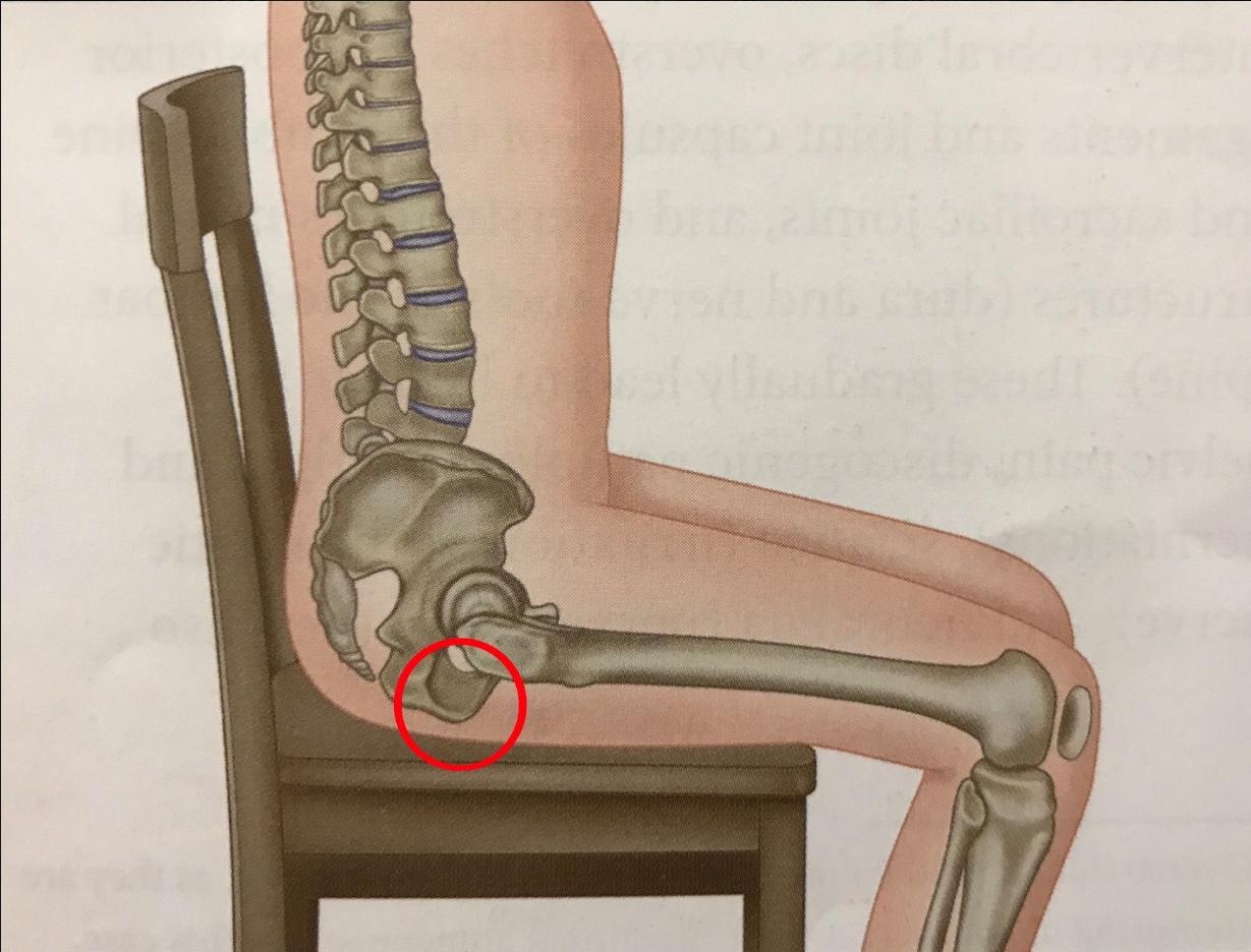 坐骨疝，主要的检查方法有白细胞计数，以及X线检查，B超等方法