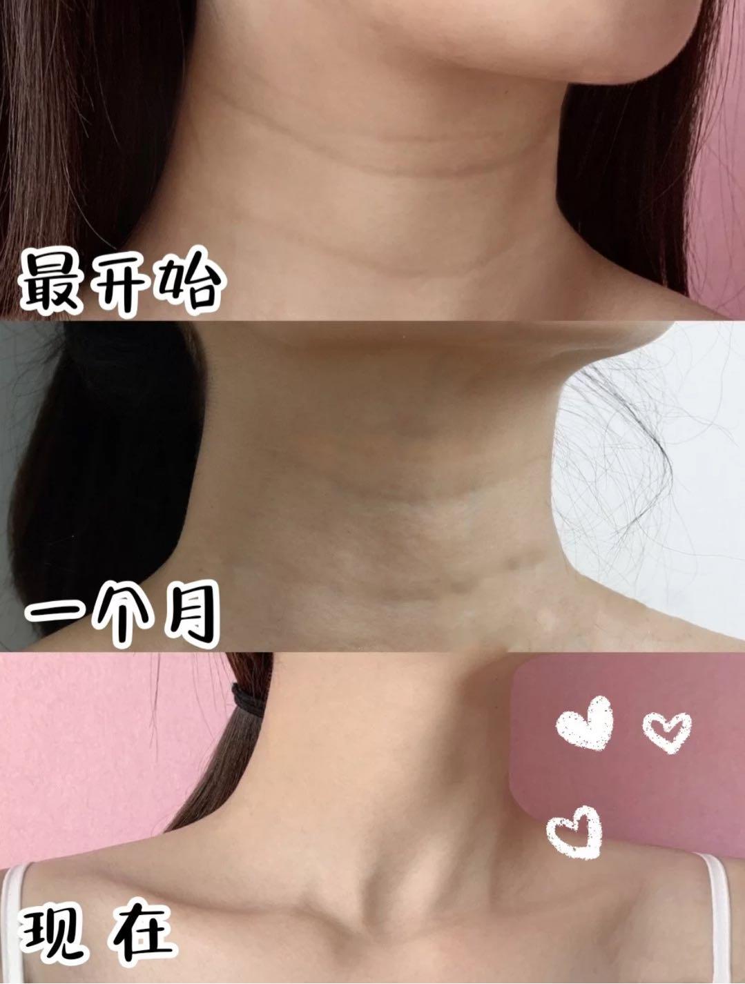 为什么不建议种下睫毛,为什么不要去种睫毛