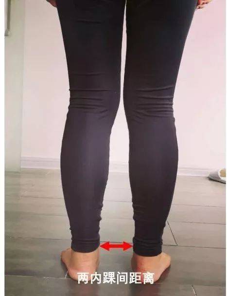 萝卜腿怎么改善肌肉腿,萝卜腿怎么三天快速瘦成筷子腿