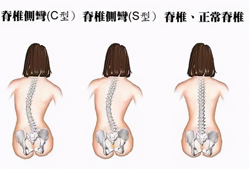 长期侧睡的危害有哪些,左卧睡姿的危害