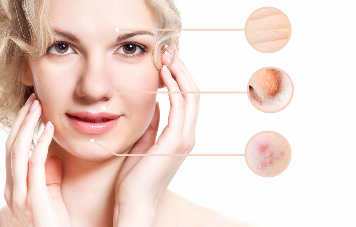 眉心长痘痘是什么原因引起的,眉心反复长痘痘是什么原因