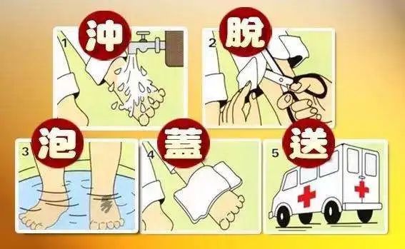 触目惊心，婴儿被热水烫伤，太揪心。如何规避和处理烫伤问题呢？