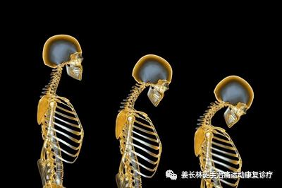 日常生活中的疼痛1—手麻(长时间玩手机)的判断和自我纠正