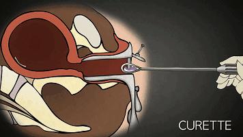 男用避孕药通过试验,网友:叫刘阳打针,半藏森林你不用吃药了