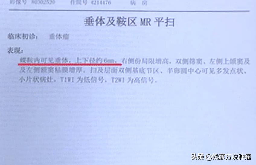 脑垂体核磁发现一个小结节,脑垂体有结节没症状需要手术吗