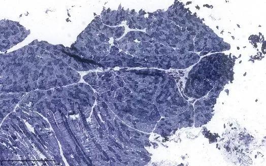 重度高碳酸血症突出表现,出现消化系统疾病的临床表现