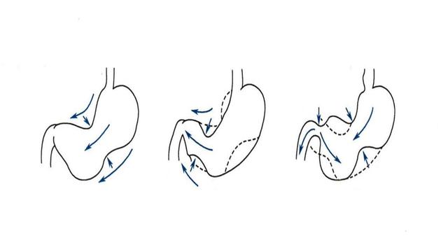 胃痛有胃药，但吃胃药，胃还痛
