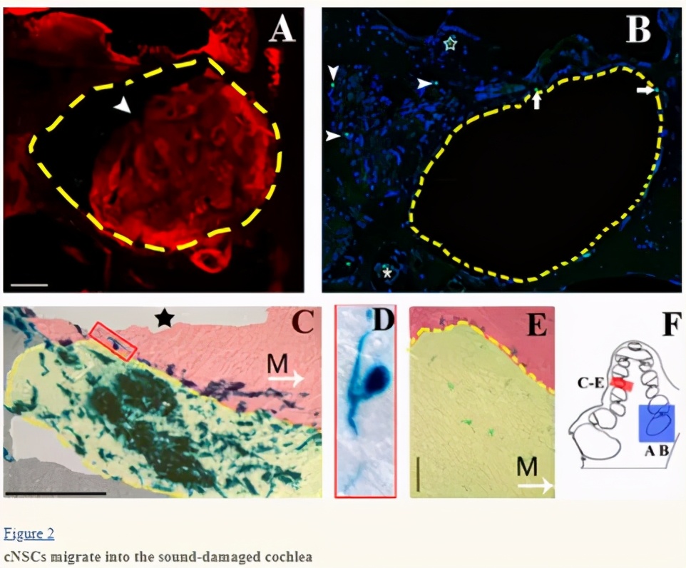 最新研究：干细胞向治疗遗传性耳聋迈进