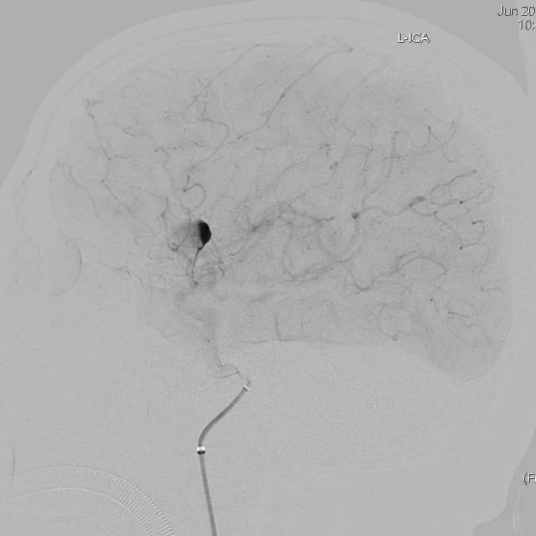 山西省人民医院任少华教授,山西省人民医院任少华