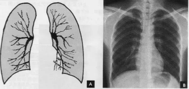 休闲小白鞋夏,献血小板相当于献血多少