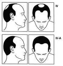 三招防脱告别秃头,防脱小绿瓶拯救你的发际线