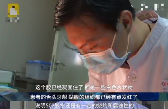 宝宝误食502胶水牙齿被粘住,宝宝误食502胶有副作用吗