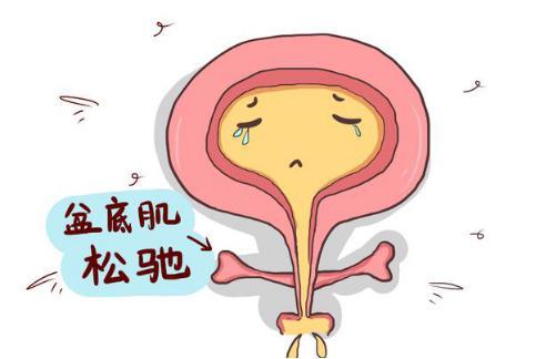 笑尿了怎么治疗,笑尿了具体是什么病