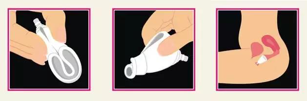 月经杯亲身测试,月经杯真的方便么