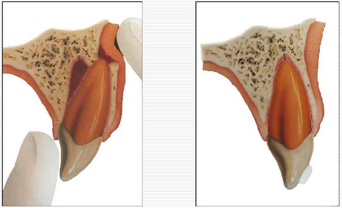 儿童牙外伤的分类及处理方法,儿童牙齿外伤需要检查哪些项目