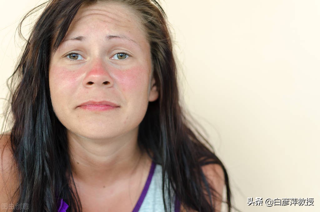 脸上的皮肤红痒肿还有点脱皮,脸上痒发红肿起皮是怎么回事