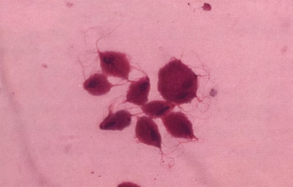 几块钱一瓶的甲硝唑，或能帮助摆平这4种病，可能多数人还不知道