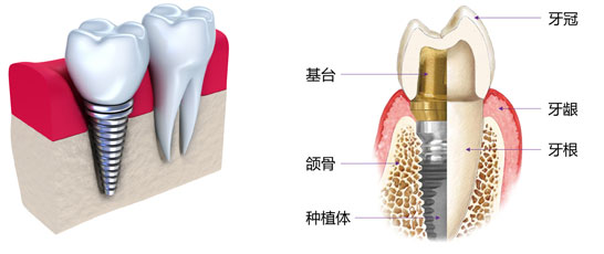 牙医为什么先治疗牙周病最后补牙,中山口腔医院治疗牙周病
