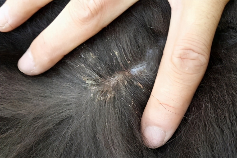 陕西渭南：一幼儿园女孩染头虱，奶奶用夹板烫死30多只