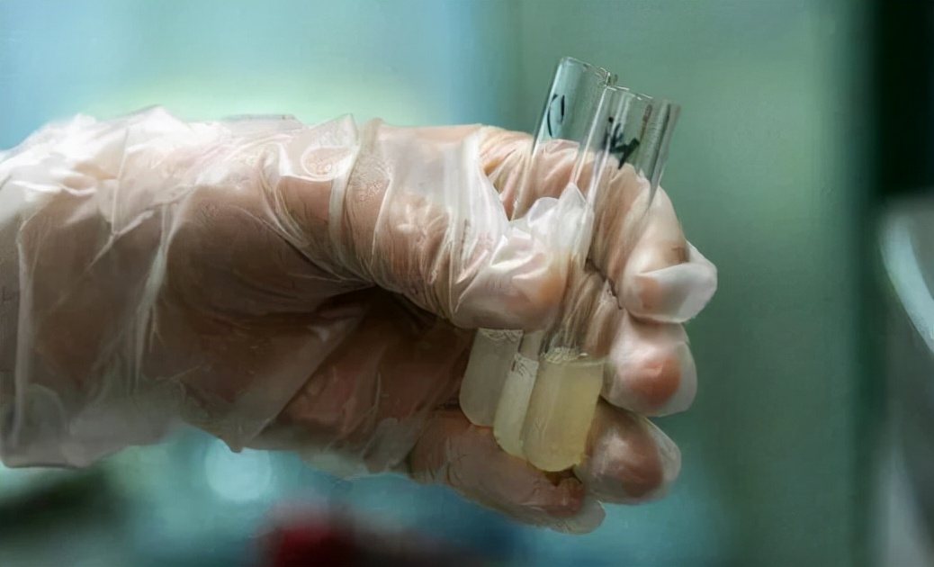 为赚5000元外快，宝爸去医院“捐精”，宝妈：风险不大但不接受