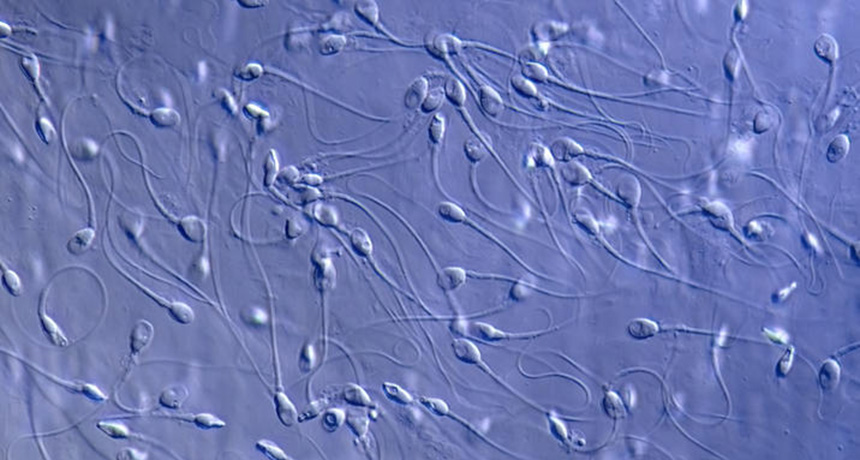 科学家研究精子运动过程，视频显示行动缓慢的毫不留情被淘汰了