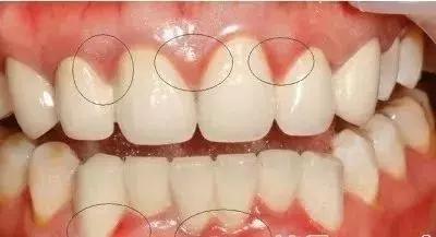 牙齿痛怎么办教你一招搞定牙痛,牙痛怎么样判断牙齿什么问题