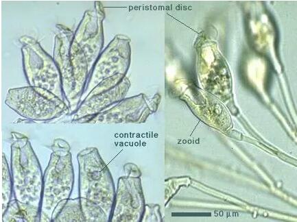 收藏!24种污水处理微生物菌相及指导意义,环保人必看(多图)