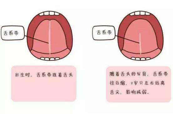 为什么有的小孩说话早有的说话迟,小孩说话早聪明还是说话晚聪明