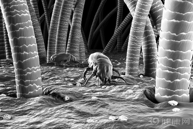 脸上的螨虫洞会愈合么,脸上螨虫多了会出油